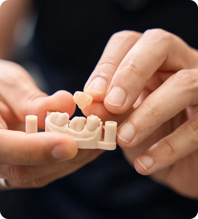 Haltbarkeit & Pflege von Zahnersatz