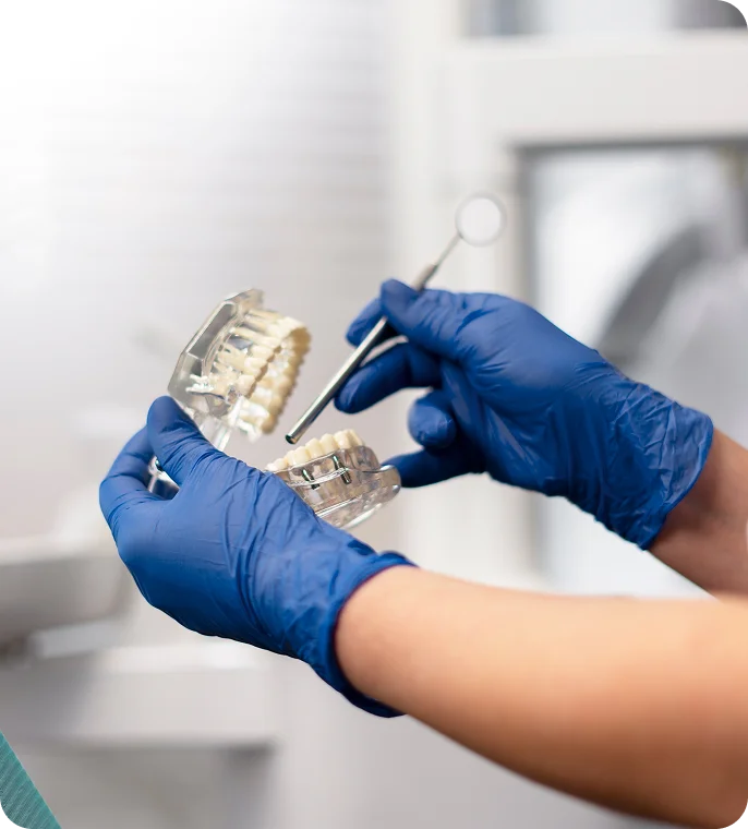 Zahnersatz – Funktion und Ästhetik im Einklang