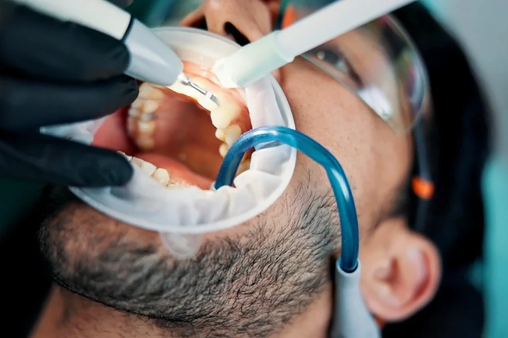 Zahnreinigung Instrumente – Dental Dam & Zahnarztwerkzeuge